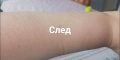 Компактен кристален уред за премахване на излишното окосмяване, снимка 6