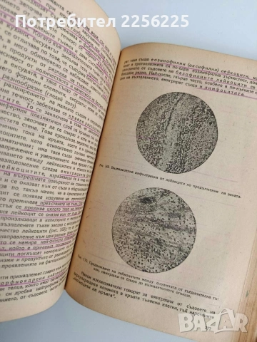 Основи на общата патологична анатомия, снимка 3 - Специализирана литература - 54439759