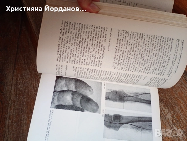 Стари книги по медицина, вътрешни болести, снимка 4 - Специализирана литература - 54833433