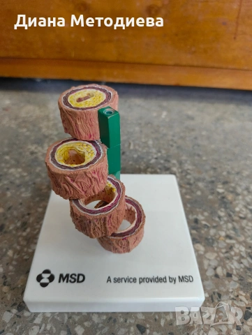 Анатомичен модел на кръвоносен съд (артерия) – медицински учебен модел