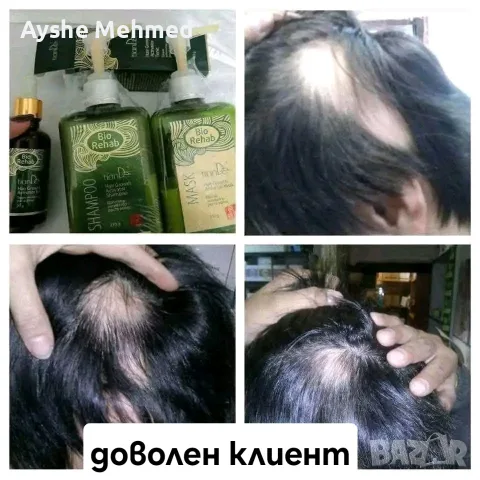 Комплект за растеж на косата „Bio Rehab“ Комплект за растеж на косата „Bio Rehab“ е разработен с цел
