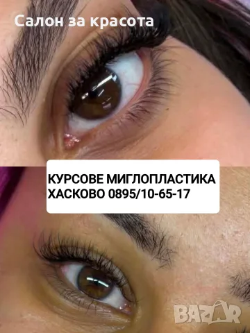 Курсове миглопластиката Хасково 0895/10-65-17