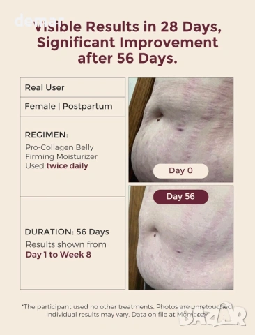 Крем против стрии Momcozy за бременност, стягащ хидратиращ крем с про-колаген, 30 грама, снимка 11 - Козметика за тяло - 54027770