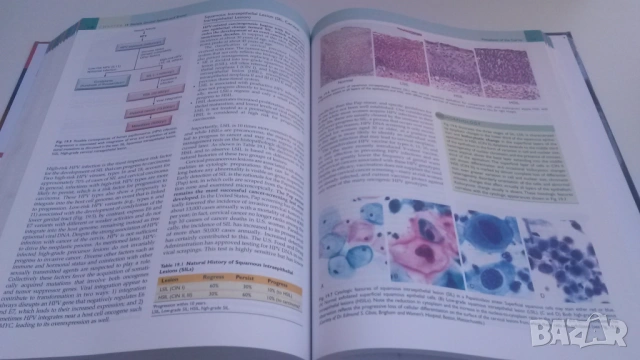 Основна патология - Basic Pathology - Robbins, 10-то издание, снимка 12 - Учебници, учебни тетрадки - 54084484