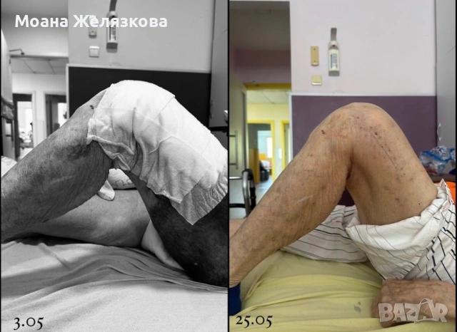 Моана Желязкова: рехабилитация - Варна, снимка 6 - Медицински, стоматологични - 53967247