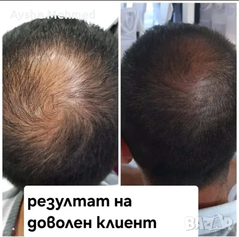 Комплект за растеж на косата „Bio Rehab“ Комплект за растеж на косата „Bio Rehab“ е разработен с цел, снимка 2 - Други - 55703497