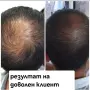 Комплект за растеж на косата „Bio Rehab“ Комплект за растеж на косата „Bio Rehab“ е разработен с цел, снимка 2