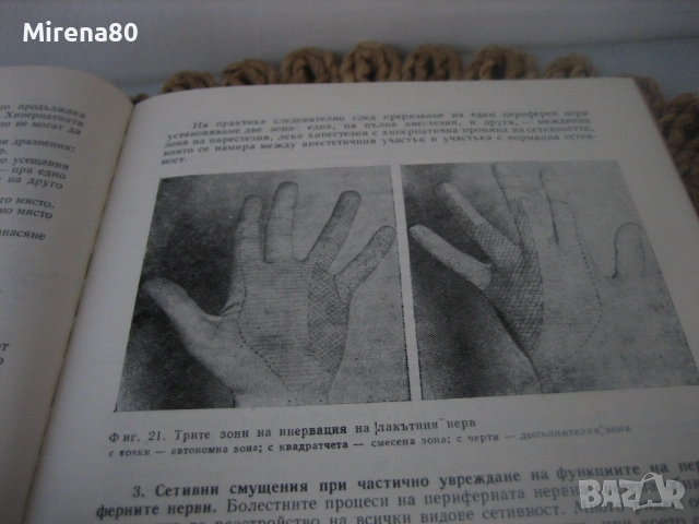 Неврология - 1978 г., снимка 5 - Специализирана литература - 54715493