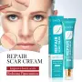 Sadoer Repair Scar Cream - крем против белези, снимка 2