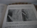 Неврология - 1978 г., снимка 5