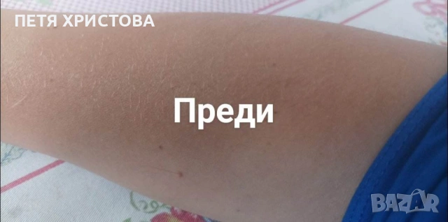 Компактен кристален уред за премахване на излишното окосмяване, снимка 5 - Други - 54795414