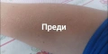 Компактен кристален уред за премахване на излишното окосмяване, снимка 5