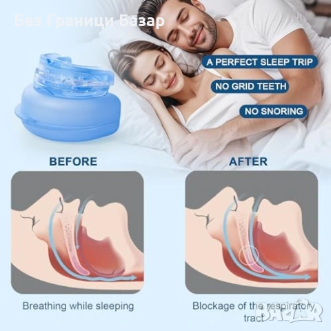 Ново Анти Хъркане Устройство Мундщук Регулируем Dental Guard За Мъже И Жени С Калъф, снимка 5 - Други - 54810883