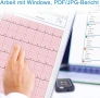 ЕКГ монитор ViATOM Pulsebit-EX, снимка 8