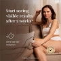 SILK’N INFINITY FAST – КОМПАКТНА EHPL™ IPL СИСТЕМА ЗА ФОТОЕПИЛАЦИЯ, снимка 7