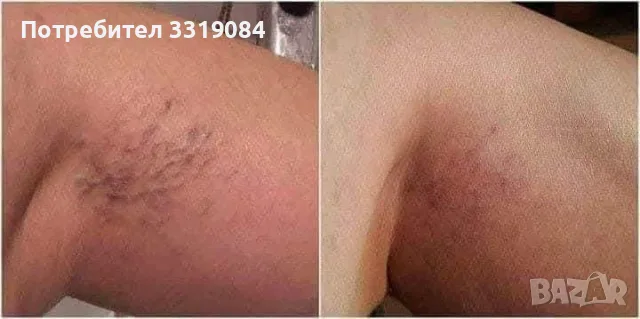 ФИТОГЕЛ Славитон , снимка 4 - Други - 55455511